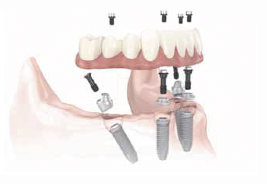 ノーベルガイド