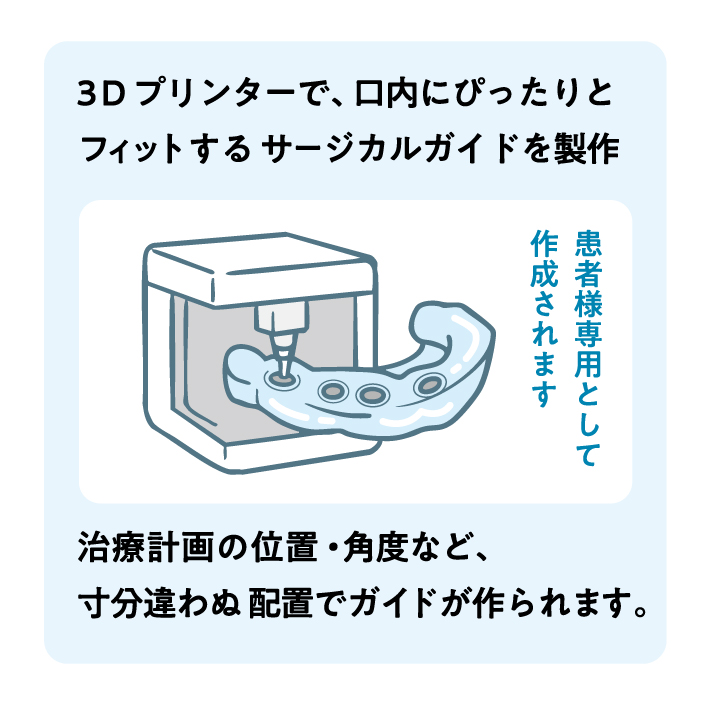 高精度サージカルガイド作製