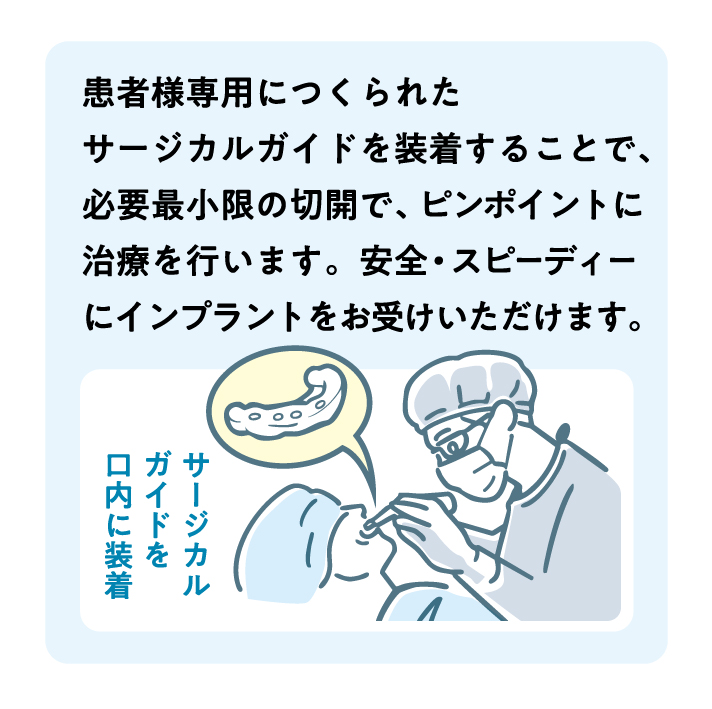 高精度サージカルガイド作製